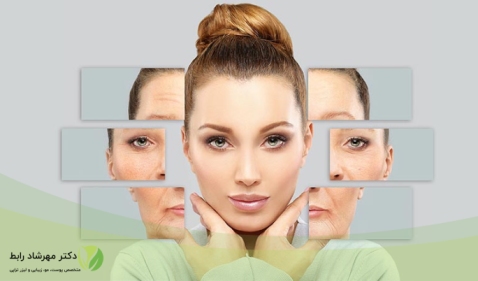 کرم زدن بعد از بوتاکس