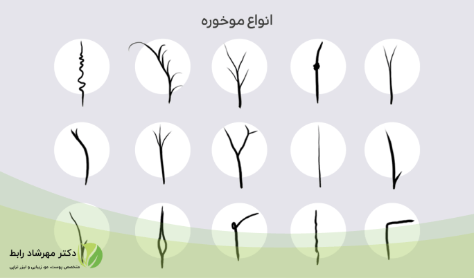 انواع مختلف موخوره