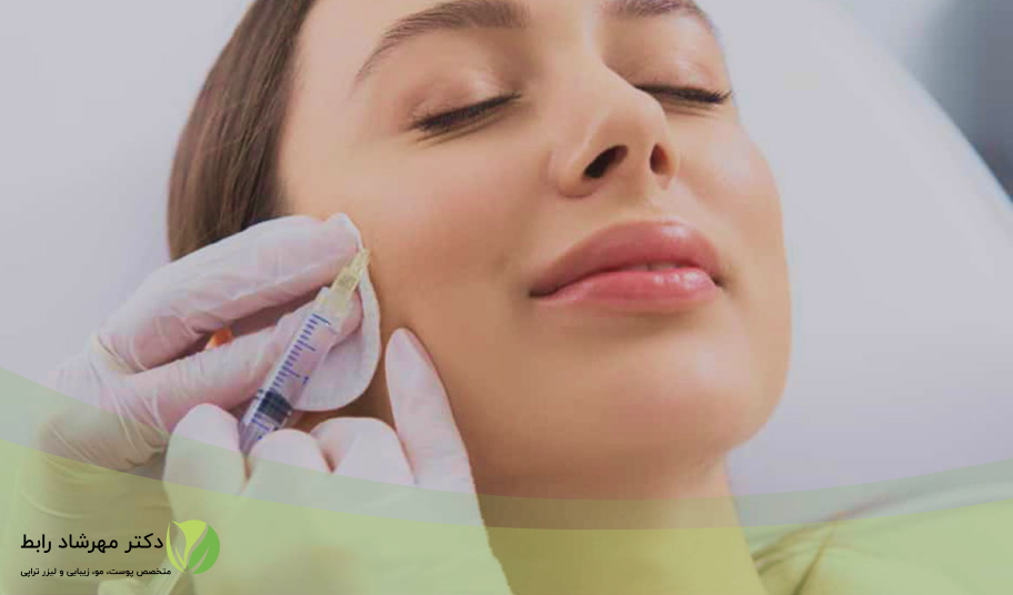 آرایش بعد از تزریق ژل لب و گونه