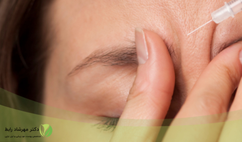 تزریق بوتاکس در شیردهی