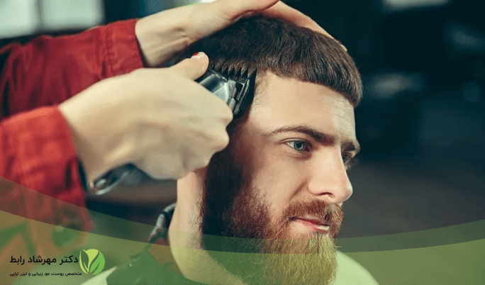 اصلاح سر بعد از کاشت مو