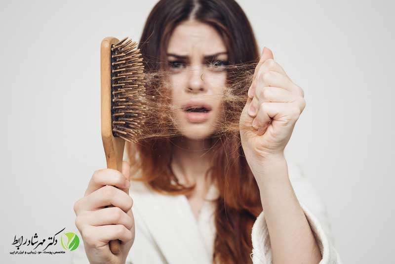 علت ریزش مو در زنان
