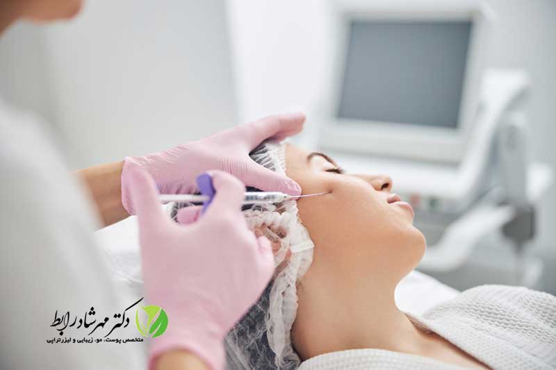 تزریق-ژل-مخصوص-هیدرودرمی