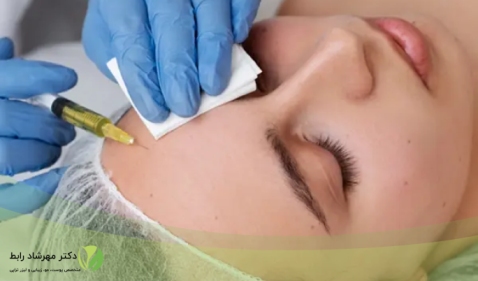آلرژی به بوتاکس