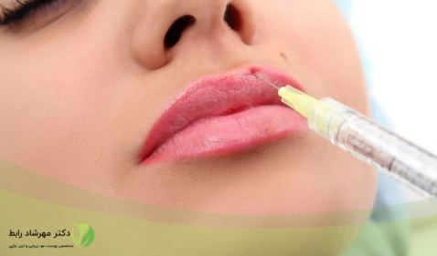 علت زود جذب شدن ژل لب - راهکارهای افزایش ماندگاری ژل لب