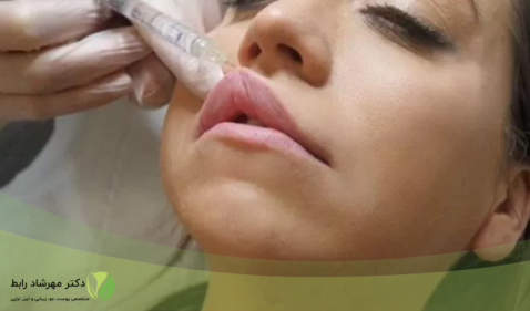 روش افزایش ماندگاری ژل لب