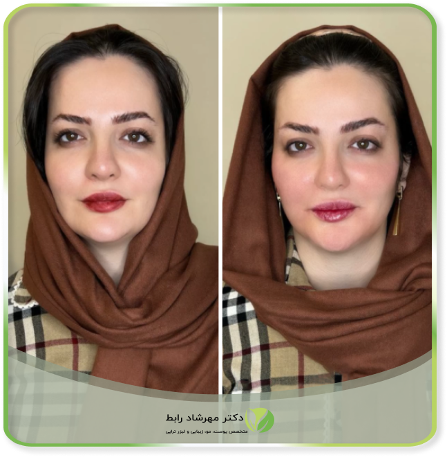 عکس-قبل-بعد-MD-codes