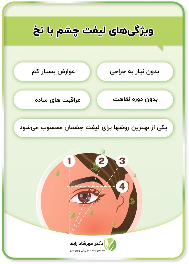 اینفوگرافی لیفت چشم با نخ