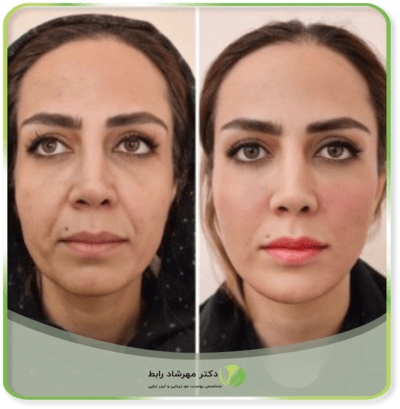 قبل-بعد-md-codes